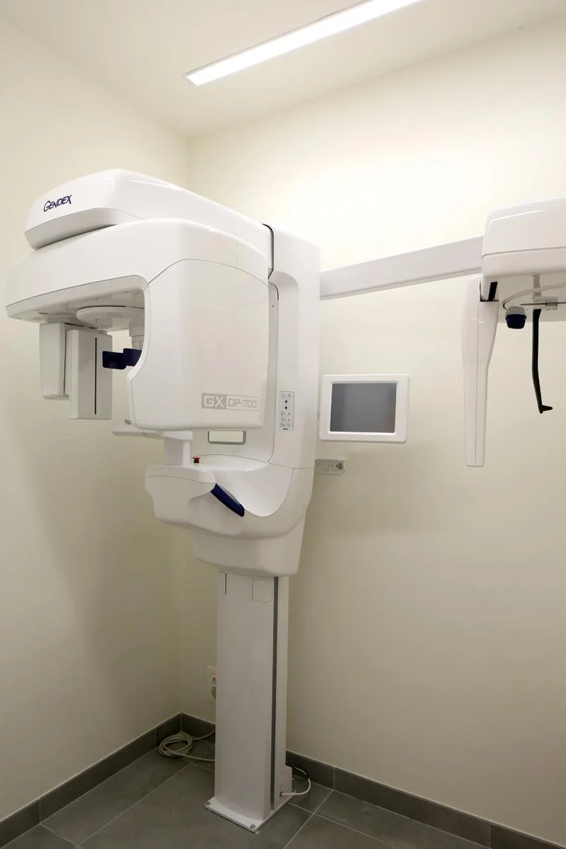 Advanced Digital Dental X-Ray System - Aligning Dentistry