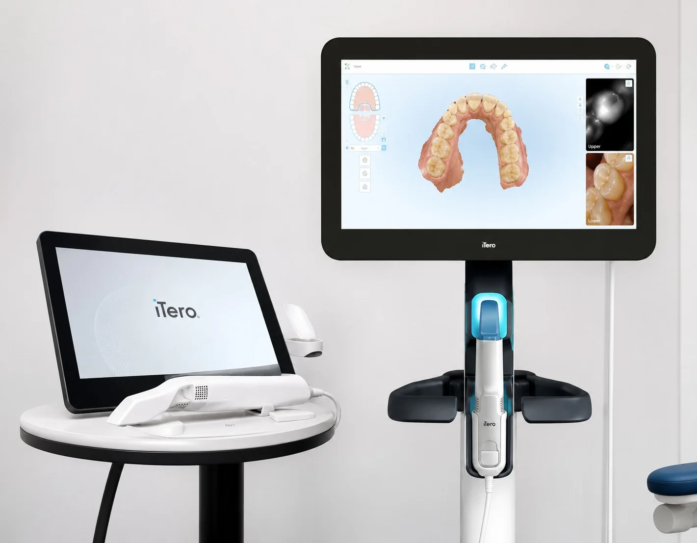 iTero Lumina Digital Intraoral Scanner - Aligning Dentistry